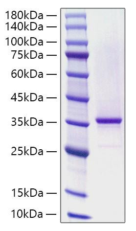 Recombinant Human KLHL20 Protein (RPCB1603)