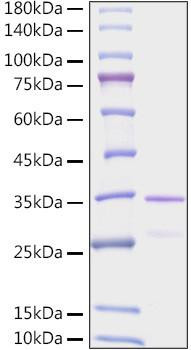 Recombinant Human EGLN1/PHD2 Protein (RPCB1620)