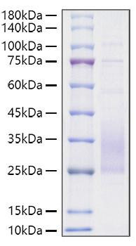 Recombinant Mouse TREM2 Protein (RPCB1621)