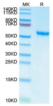 Recombinant Human ROR2 Protein (RPCB1622)