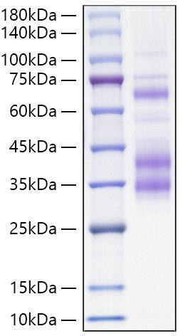 Recombinant Mouse Clusterin/Apo-J/CLU Protein (RPCB1676)