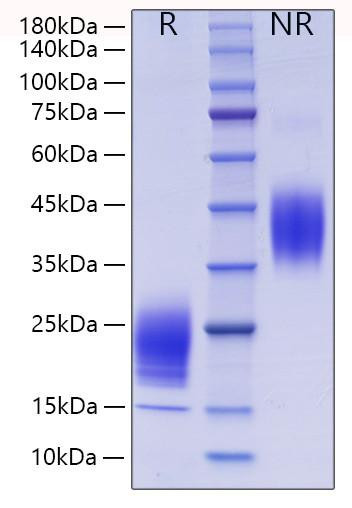 Recombinant Mouse IL-5 Protein (RPCB1699)