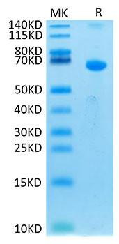 Recombinant Human TSLPR Protein (RPCB1702)