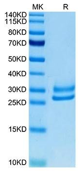 Recombinant Human IL-15RA&IL-15 Protein (RPCB1744)