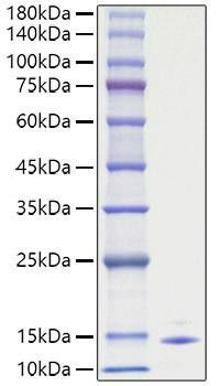 Recombinant Human CCL5/RANTES Protein (RPCB1777)