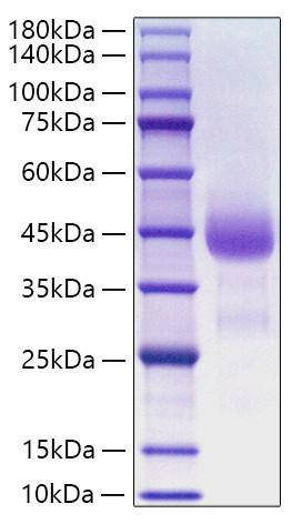 Recombinant Human Cathepsin B Protein (RPCB1791)