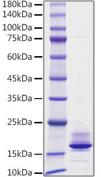 Recombinant Human Calcitonin/CALCA Protein (RPCB1802)