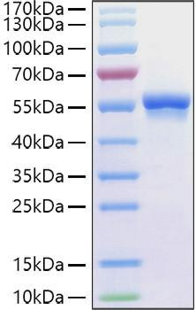 Recombinant Human Glucose-6-phosphate 1-dehydrogenase/G6PD Protein (RPCB1850)