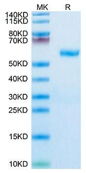 Recombinant Human RNF43 Protein (RPCB1864)