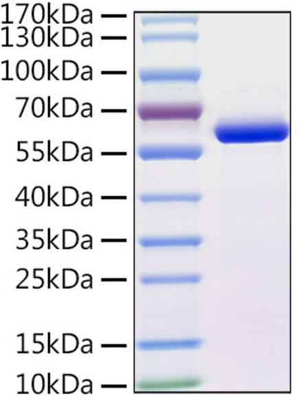 Recombinant Human TUBB4A Protein (RPCB1873)