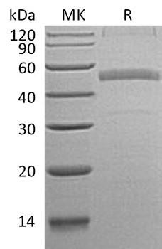 Recombinant Human Calumenin/CALU Protein (RPCB1874)