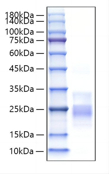 Recombinant Mouse TNFSF8/CD30 Ligand/CD153 Protein (RPCB1899)
