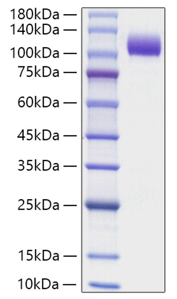 Recombinant Human NCAM-1/CD56 Protein (RPCB1904)