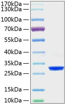 Recombinant Human PRDX4 Protein (RPCB1920)