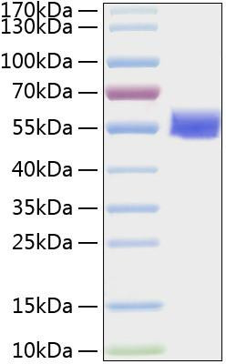 Recombinant Human Vimentin/VIM Protein (RPCB1921)