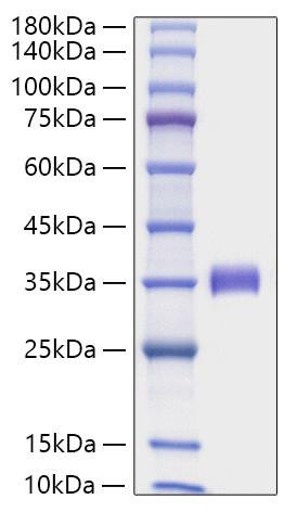 Recombinant Human Angiopoietin-2/ANG-2/ANGPT2(275-496) Protein (RPCB1940)