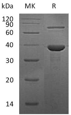 Recombinant Human Retinol-binding protein 3/RBP3 Protein (RPCB1950)