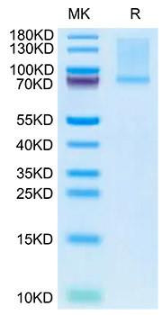 Recombinant Mouse GAS-6 Protein (RPCB1983)