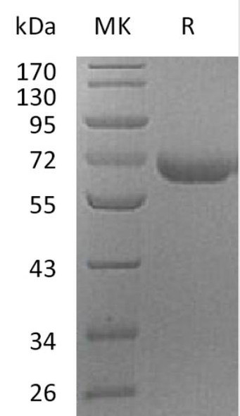 Recombinant Human PRCP Protein (RPCB1986)
