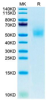 Recombinant Mouse DLK1 Protein (RPCB1999)