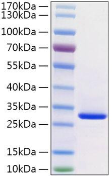 Recombinant Human VSIG8 Protein (RPCB2020)