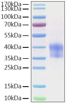 Recombinant Mouse Cathepsin B Protein (RPCB2023)
