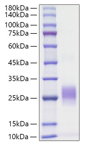 Recombinant Human TNFSF6/FAS ligand/CD178 Protein (RPCB2052)