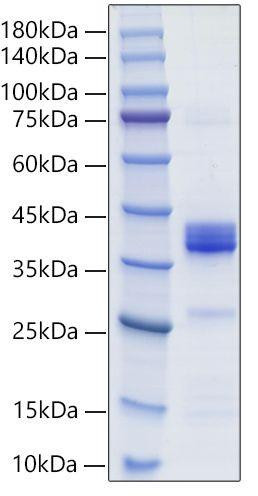 Recombinant Mouse IgG2B Protein (RPCB2064)