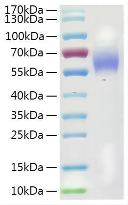 Recombinant Mouse Galectin-9/LGALS9 Protein (RPCB2075)