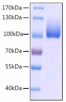 Recombinant Human CFHR4 Protein (RPCB2112)