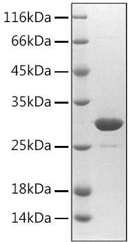Recombinant Human Fibrillin-1/FBN1 Protein (RPCB2125)
