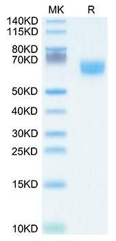 Recombinant Human FGFR-2 beta (IIIb)/KGFR/CD332 (253-378) Protein (RPCB2157)