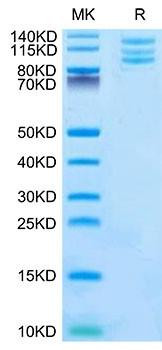 Recombinant Mouse Integrin alpha V beta 6 (ITGAV&ITGB6) Heterodimer Protein (RPCB2173)
