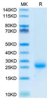 Recombinant Cynomolgus IL-31 Protein (RPCB2182)
