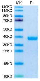 Recombinant Mouse FSTL3 Protein (RPCB2198)