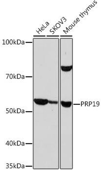 Anti-PRP19 Antibody (CAB9660)