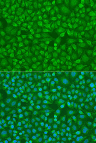 Anti-IRF7 Antibody (CAB0159)