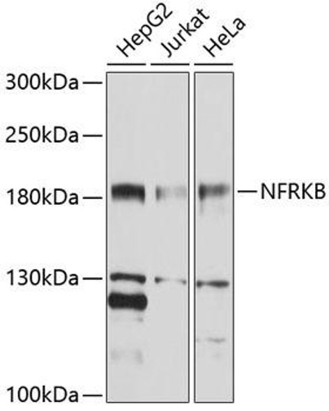Anti-NFRKB Antibody (CAB10124)