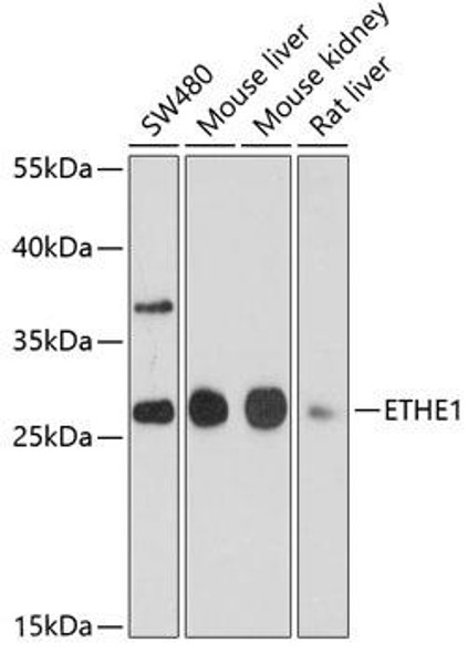 Anti-ETHE1 Antibody (CAB10142)