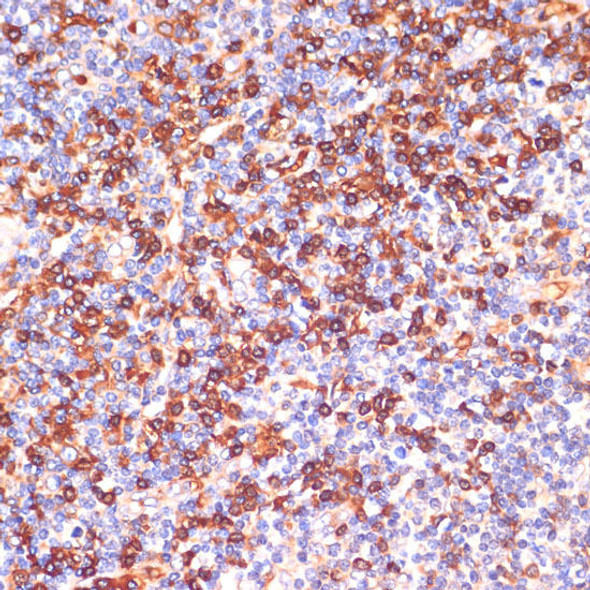 Anti-GPSM2 Antibody (CAB10553)