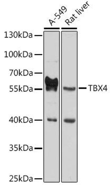 Anti-TBX4 Antibody (CAB10691)
