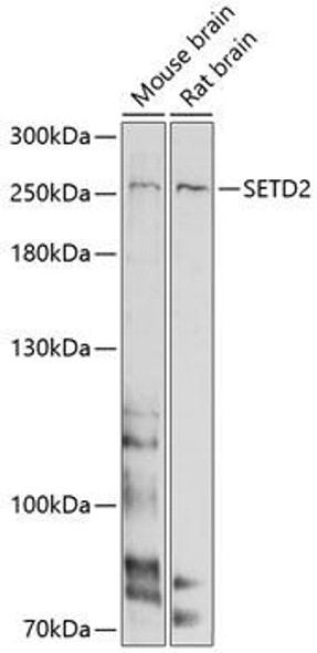 Anti-SETD2 Antibody (CAB11271)
