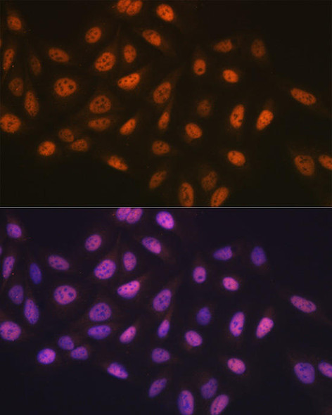 Anti-MCM7 Antibody (CAB1138)