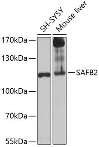 Anti-SAFB2 Antibody (CAB12550)