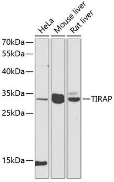 Anti-TIRAP Antibody (CAB12606)