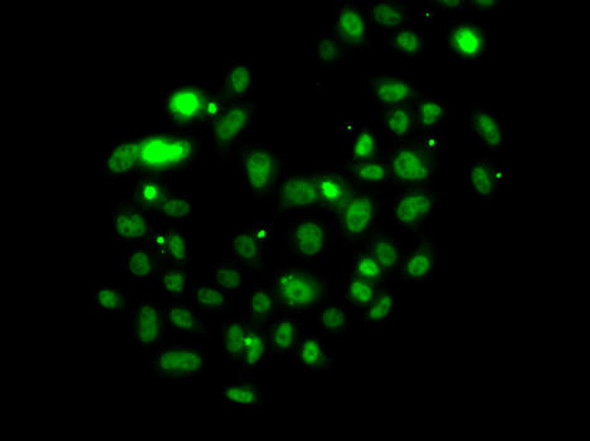 Anti-PMS2 Antibody (CAB13680)