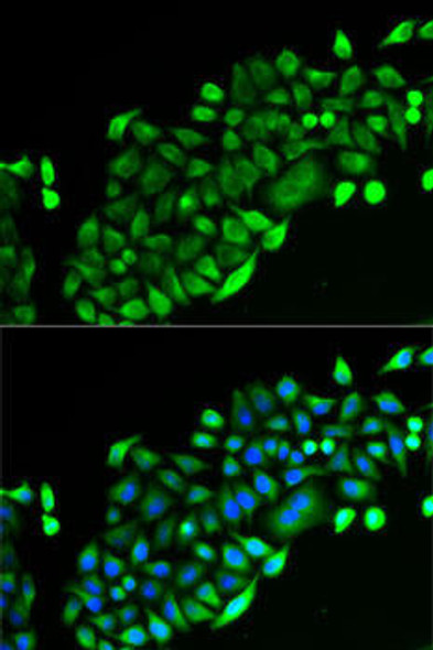 Anti-GSTO2 Antibody (CAB14156)