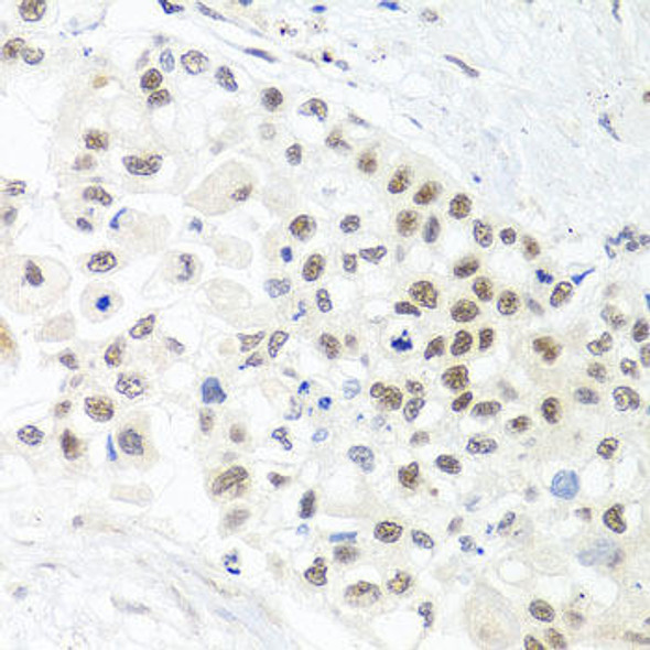Anti-TRMT1 Antibody (CAB7116)