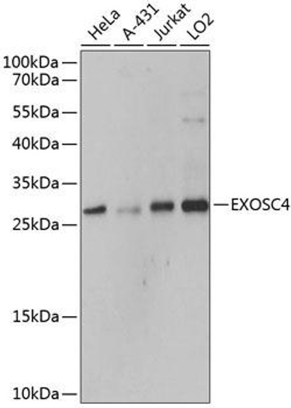 Anti-EXOSC4 Antibody (CAB9147)