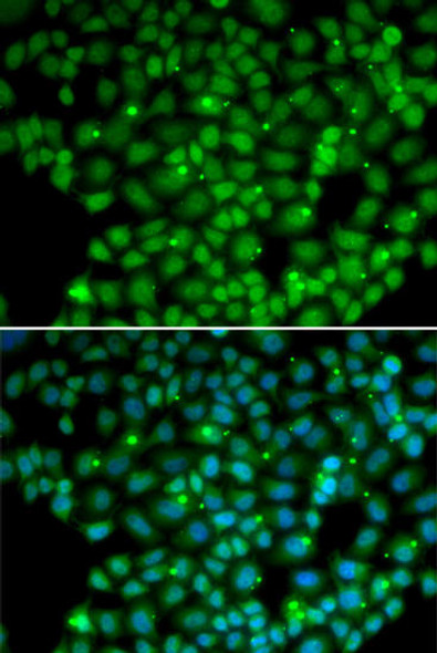 Anti-MUTYH Antibody (CAB1612)